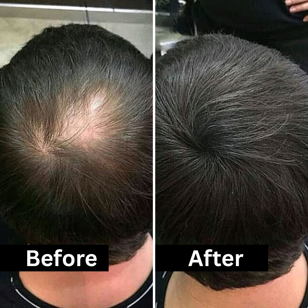 HairFill FOR HIM