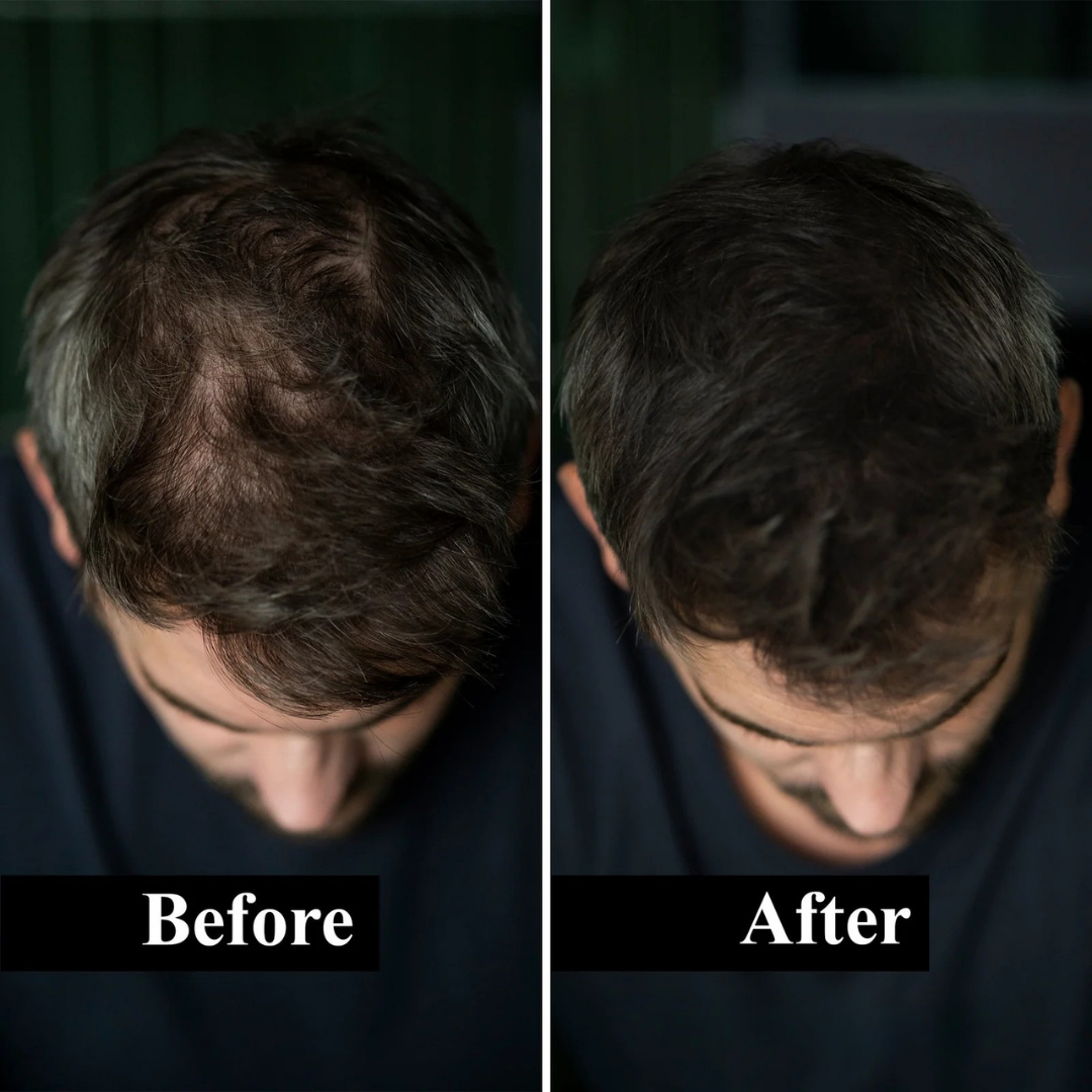 Eupholic™ HairFill