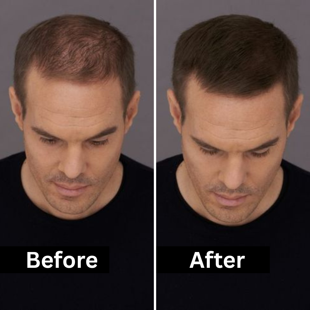 HairFill FOR HIM