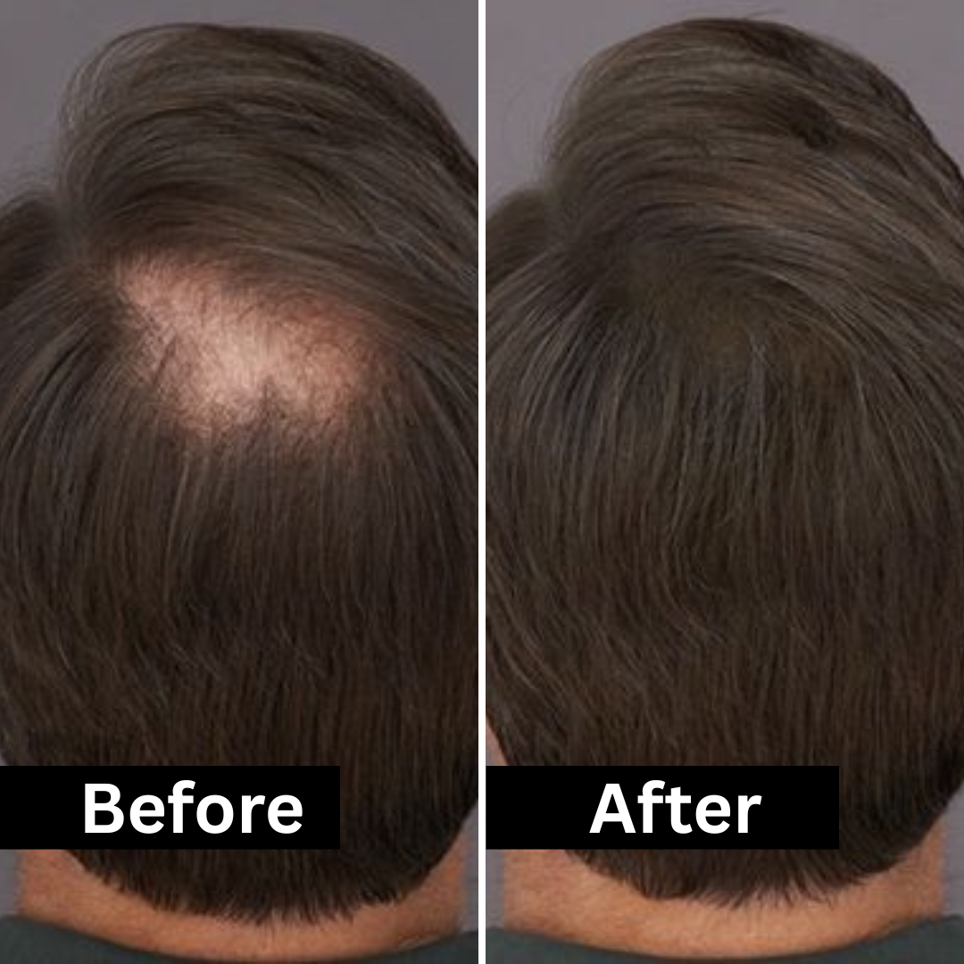 HairFill FOR HIM