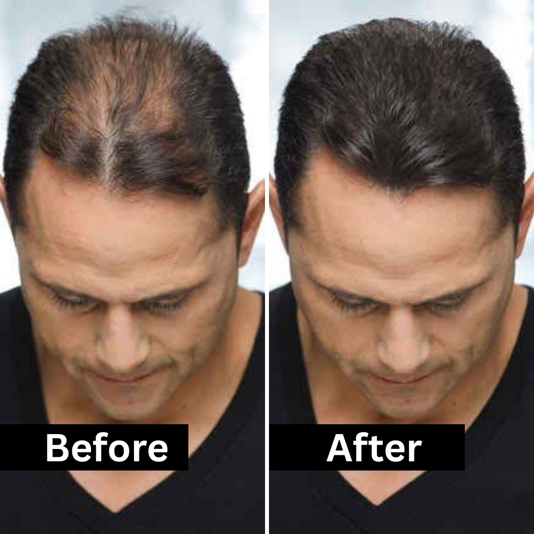 HairFill FOR HIM