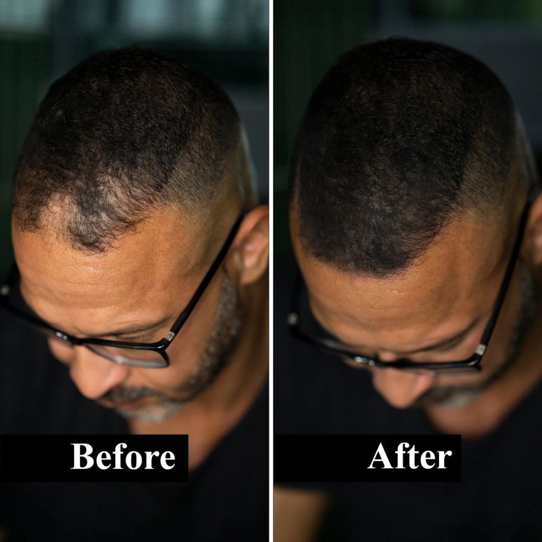 HairFill FOR HIM