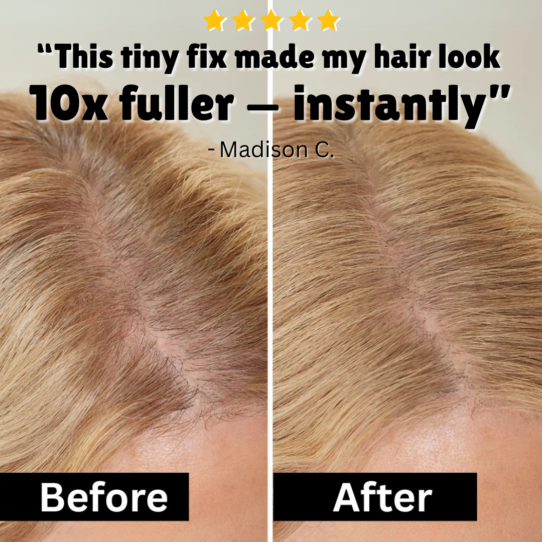 Eupholic™ HairFill