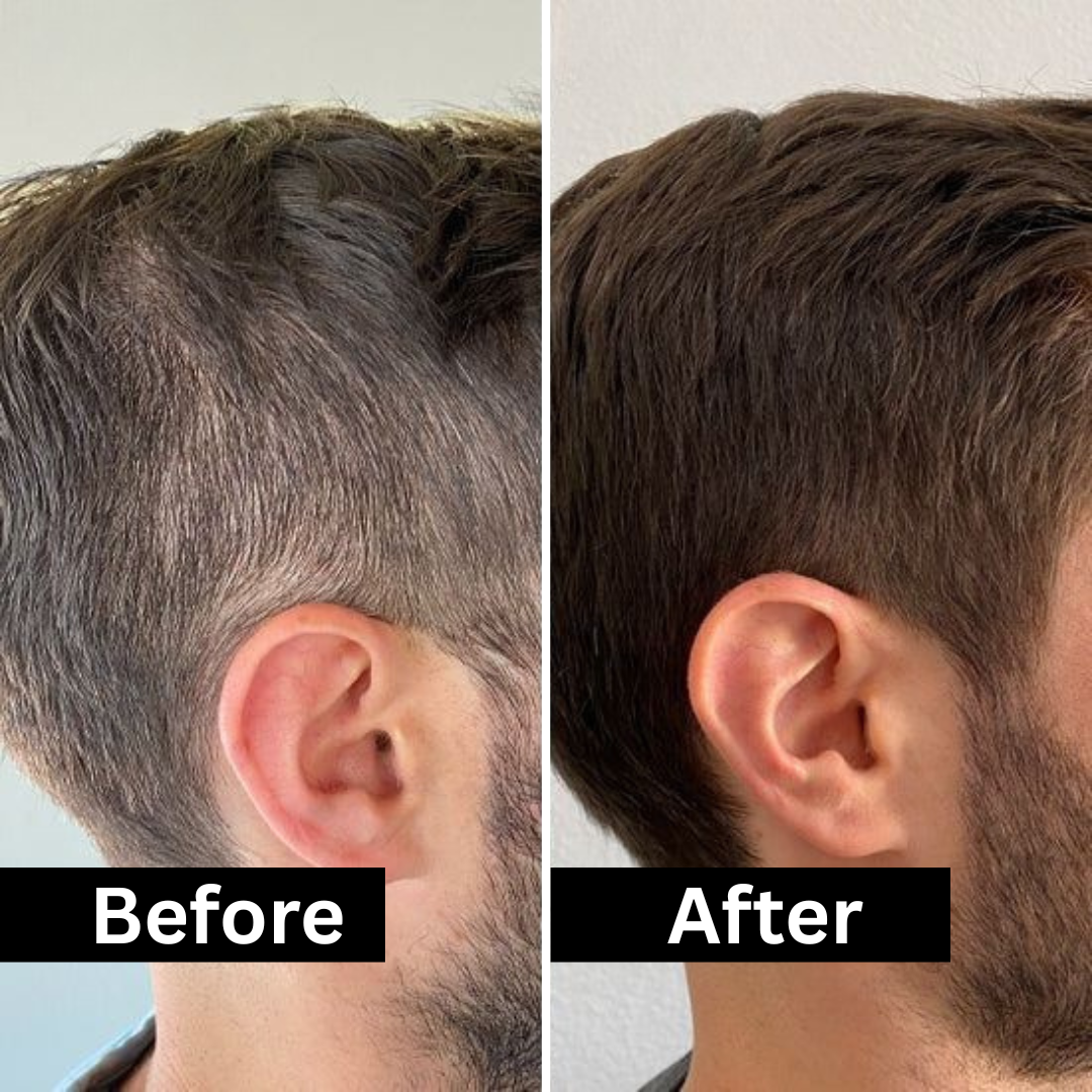 HairFill FOR HIM