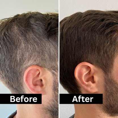 HairFill FOR HIM