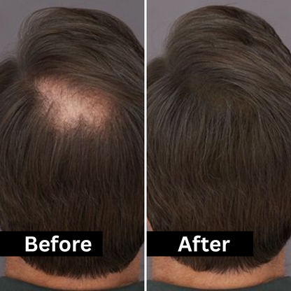 HairFill FOR HIM