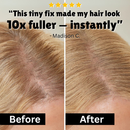 Eupholic™ HairFill
